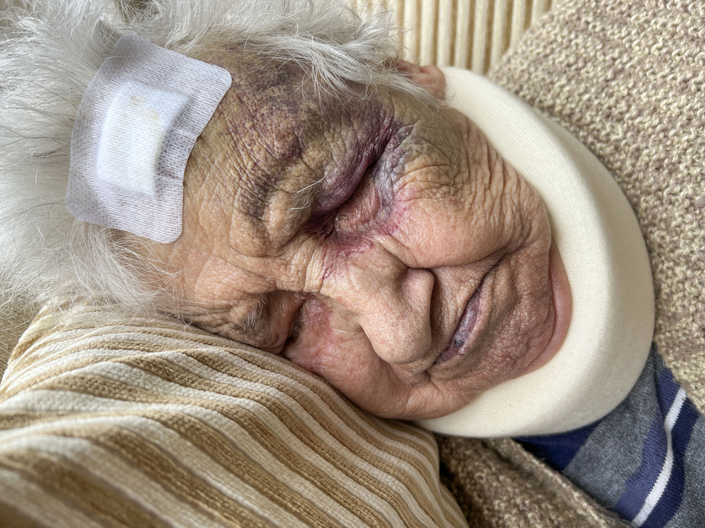 Nursing home neglect lawyer representing residents harmed by poor care