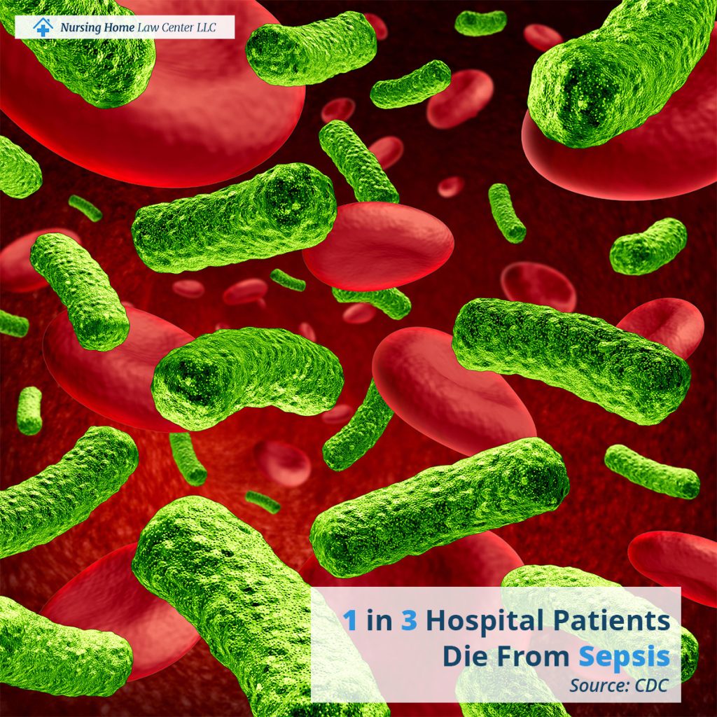 Understand your legal topions for sepsis in nursing homes