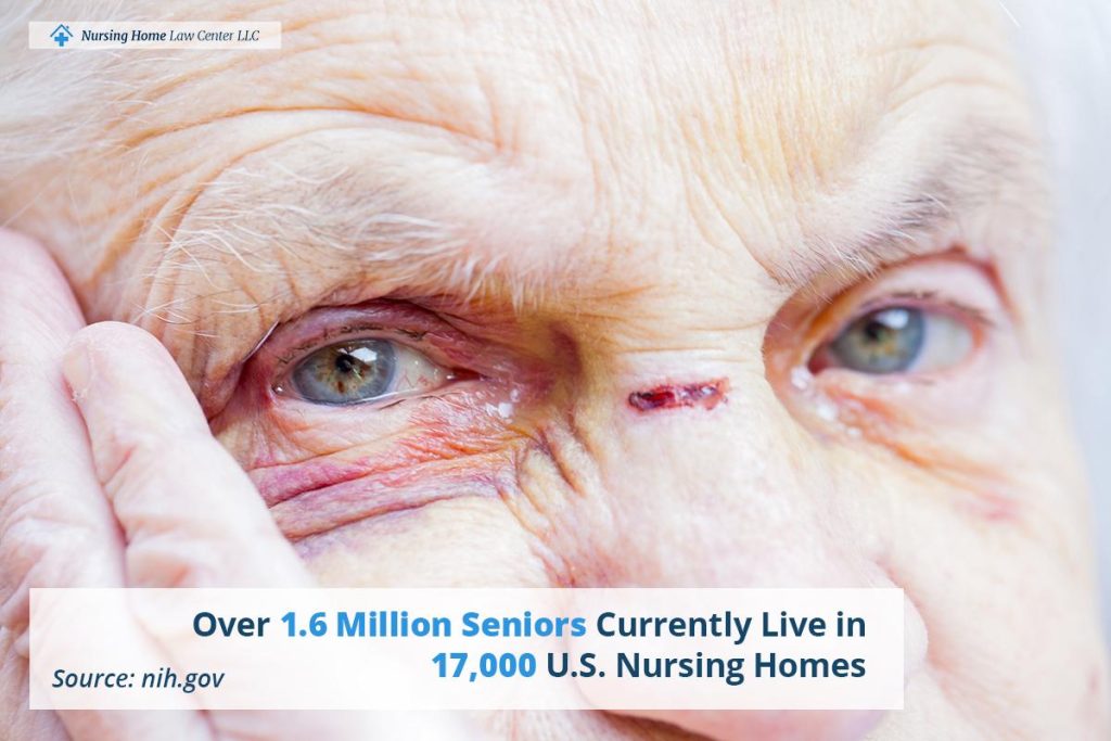 Adult Protective Services Investigating Nursing Home Abuse